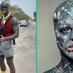 Donkere Alien' overweegt om zijn been te laten amputeren