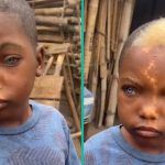 Afrikaanse peuter met blauwe ogen en unieke 'bliksemkenmerk' op zijn gezicht zet de wereld op zijn kop!