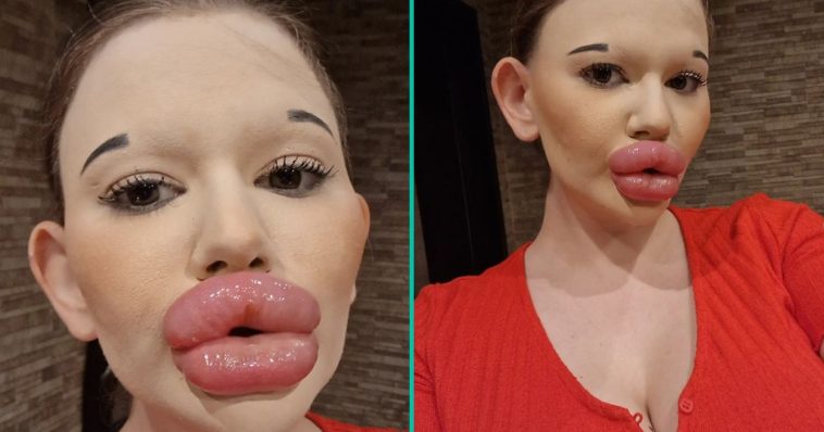 Vrouw met 's werelds grootste lippen veilt kerstkusjes onder maretak