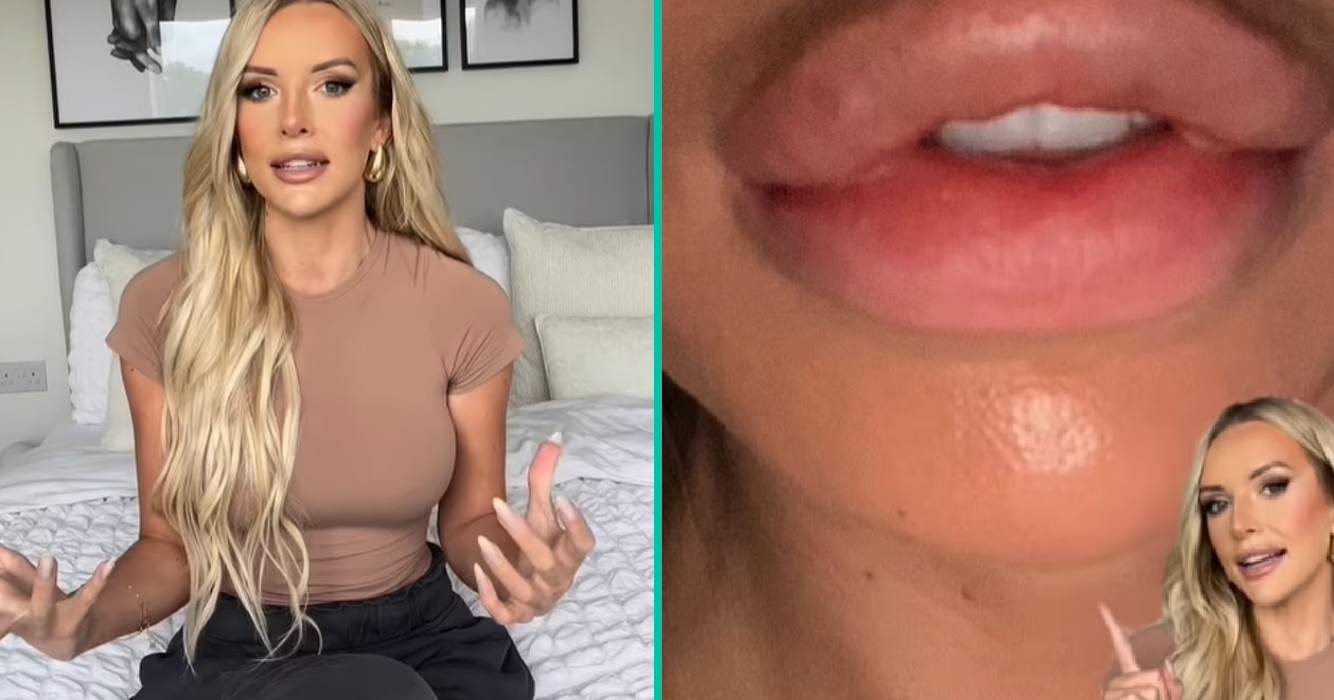 lipvullers